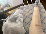 В Таганроге девушка ищет свидетелей ДТП, в котором получила травмы